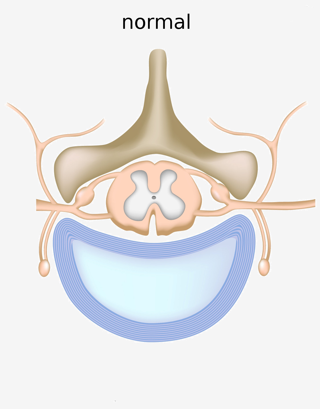 schéma d'une vertebre normal et des nerfs